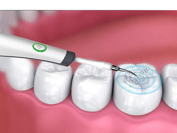 Ultrasonic dental scaler for teeth cleaning tartar removal