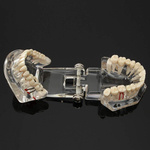 Dental model jaw teeth teeth implants