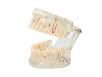 Dental model jaw teeth teeth implants