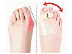 Toe separator for hallux valgus gel wedge magnet