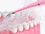 Ultrasonic dental scaler for calculus