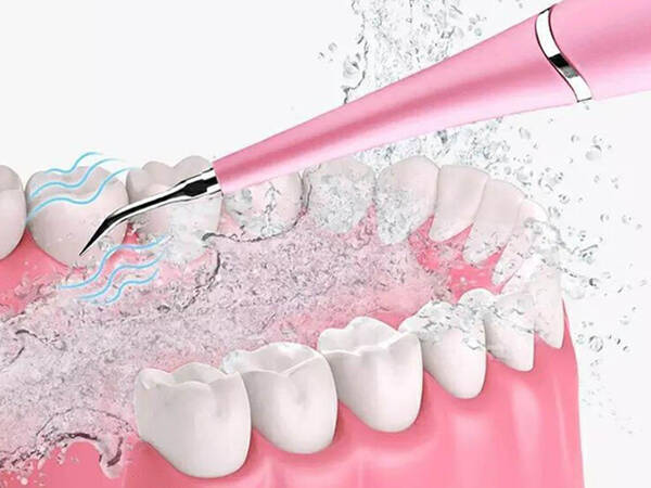 Détartreur dentaire à ultrasons pour le nettoyage des dents et l'élimination du tartre