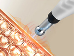 Acupuncture massager pen electrostimulator 5 tips lcd set