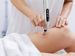 Stylo masseur d'acupuncture électrostimulateur 5 pointes set lcd