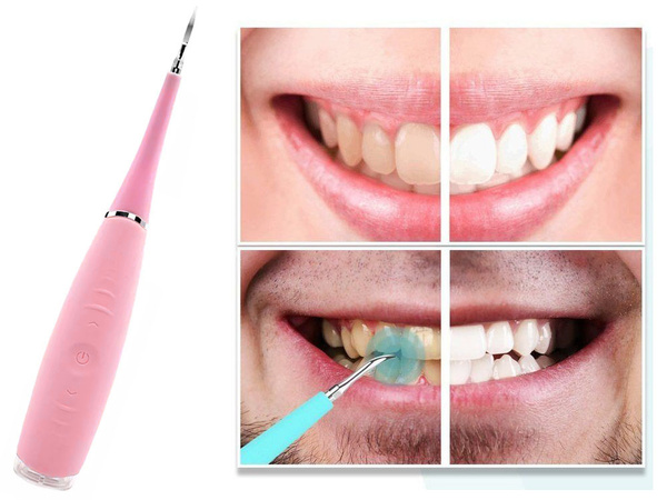 Ultraschall-zahnsteinentferner für zahnreinigung und zahnsteinentfernung