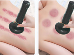 Masseur électrique à bulles chinois 6 puissances d'aspiration huile à bulles