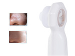 Blackhead in mozolji hoover vodil povečevalnik