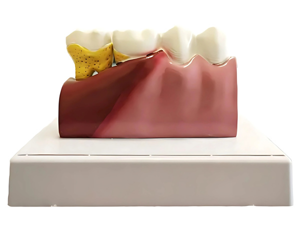 Anatomical model of a dental tooth educational cross-section removable tooth