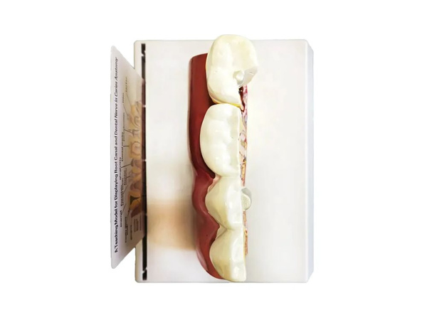 Fogászati fogatok anatómiai modellje oktatási célú keresztszeletelhető fog