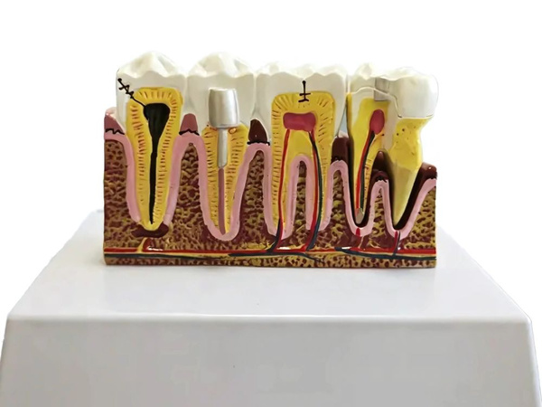 Anatomical model of a dental tooth educational cross-section removable tooth