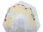 Dental model jaw teeth teeth braces
