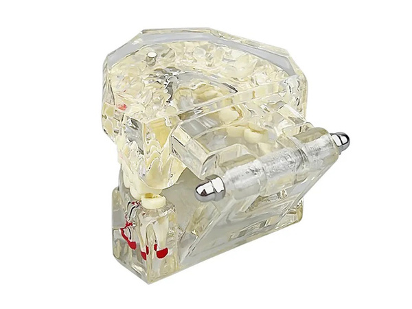 Zubný model čeľuste zuby zubné implantáty