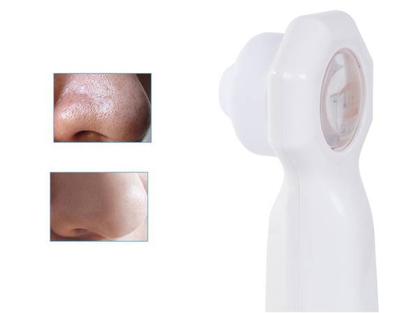 Mitesser und pickel staubsauger led lupe