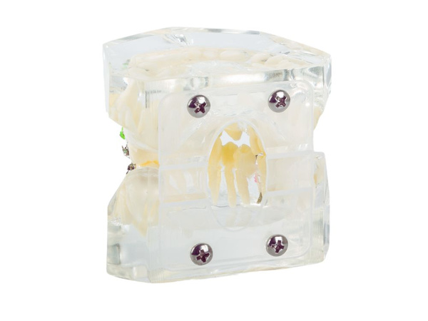 Zobu modelis žokļa zobi zobu breketes