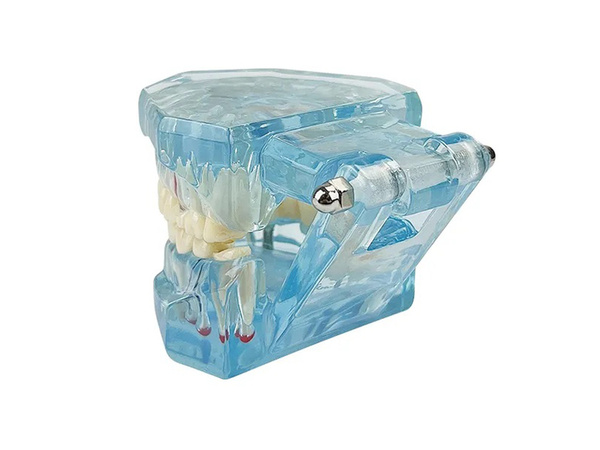 Dental model jaw teeth teeth implants