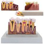 Anatomical model of a dental tooth educational cross-section removable tooth