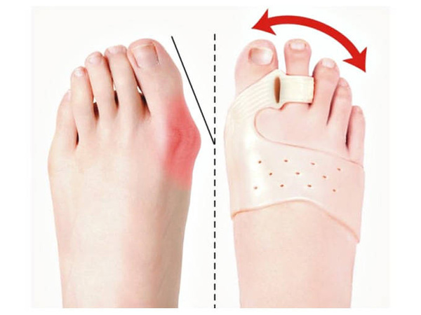 Separator de deget pentru hallux valgus gel magnet