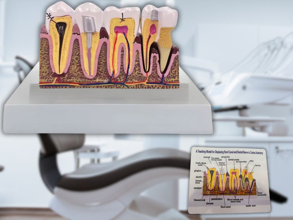 Anatomical model of a dental tooth educational cross-section removable tooth