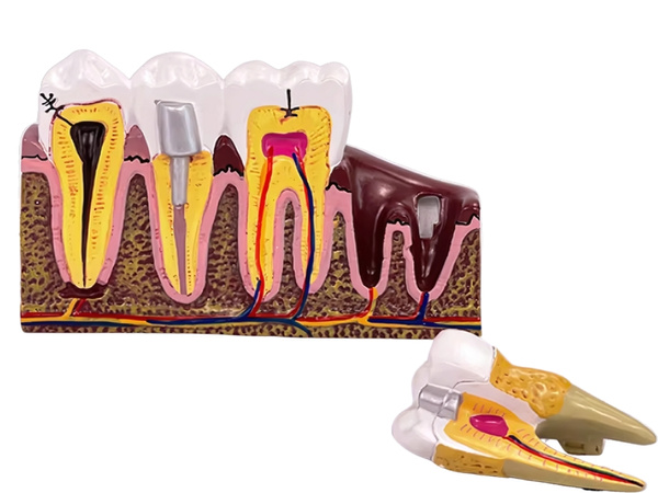 Model anatomic al unui dintu dentar secțiune transversală educațională dintu amovibil