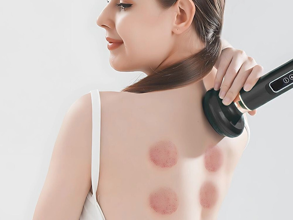 Ķīnas burbuļu elektriskais vakuuma masieris 6 sūkšanas burbuļu eļļas pilnvaras